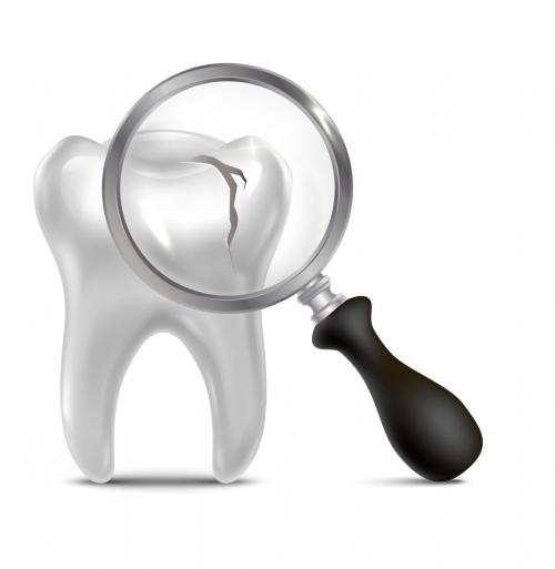 Почему зубы становятся хрупкими с возрастом: причины и решения 02