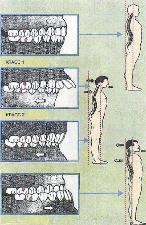 Как состояние зубов влияет на общее здоровье человека 08