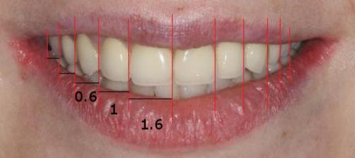 Как выглядят идеальные зубы и как часто это встречается 07