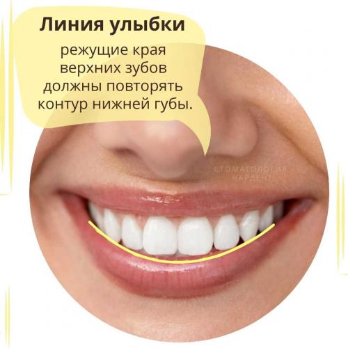 Как выглядят идеальные зубы и как часто это встречается 17 Как выглядят идеальные зубы и как часто это встречается 17