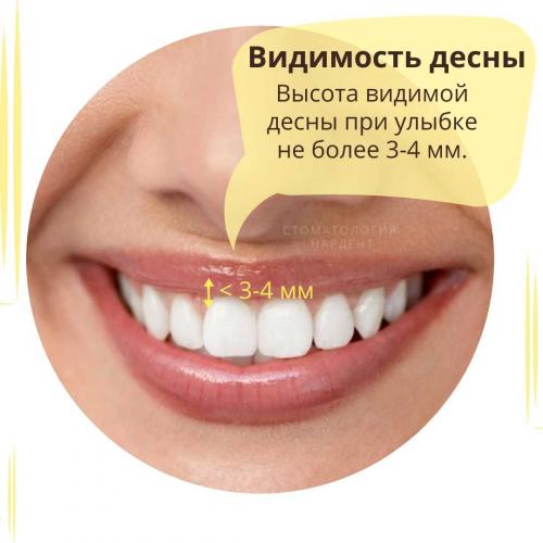 Как выглядят идеальные зубы и как часто это встречается 14 Как выглядят идеальные зубы и как часто это встречается 14