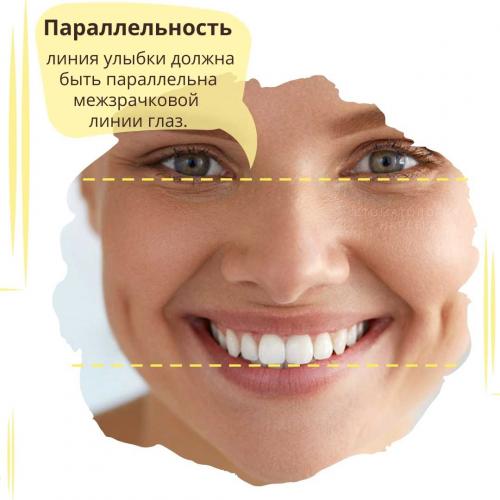 Как выглядят идеальные зубы и как часто это встречается 12 Как выглядят идеальные зубы и как часто это встречается 12