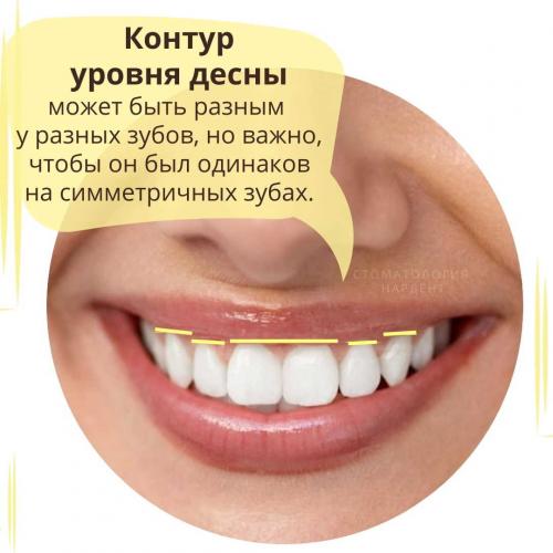 Как выглядят идеальные зубы и как часто это встречается 15 Как выглядят идеальные зубы и как часто это встречается 15