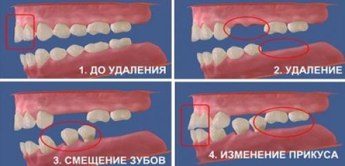 Что нужно нашим зубам: основные правила ухода 04