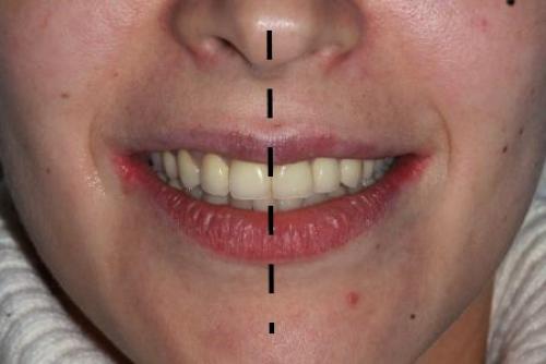 Как выглядят идеальные зубы и как часто это встречается 06