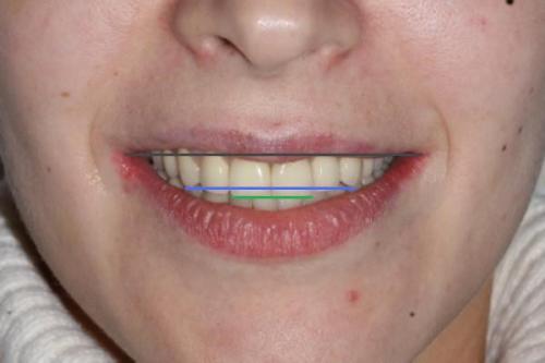 Как выглядят идеальные зубы и как часто это встречается 02