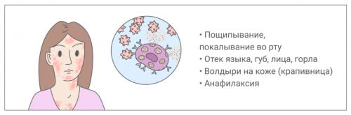 Какие симптомы могут указывать на аллергическую реакцию организма. Симптомы острой аллергической реакции