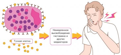 Что такое аллергия и какие ее основные причины. Как возникает аллергическая реакция?