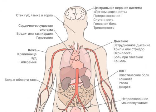 Какие продукты питания могут вызывать аллергию на руках у взрослых. Симптомы пищевой аллергии