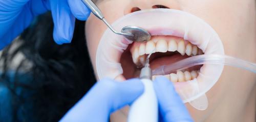 Гигиена полости рта: как обеспечить своему зубу долгую и здоровую жизнь 06