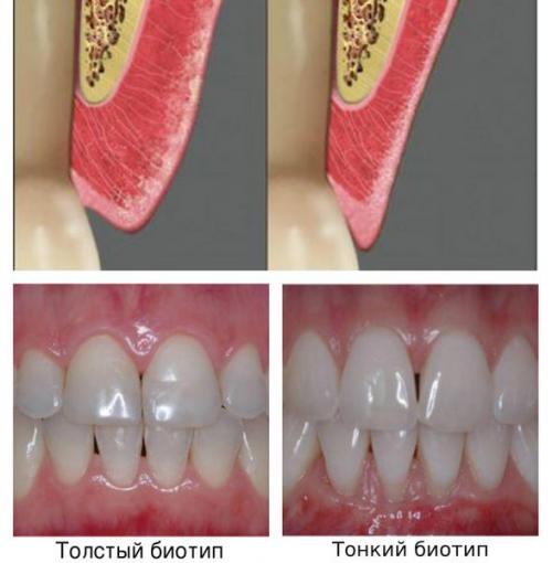 Какие симптомы могут указывать на наличие заболеваний зубов и десен