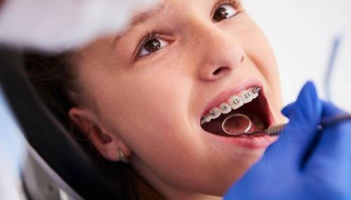 Чистка Зубов: 15 Важных Пунктов, О которых Вам Необходимо Знать 06