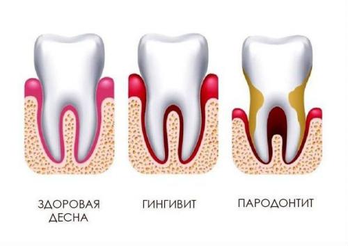 Здоровье зубов и полости рта в пожилом возрасте: основные факторы риска и профилактика 01