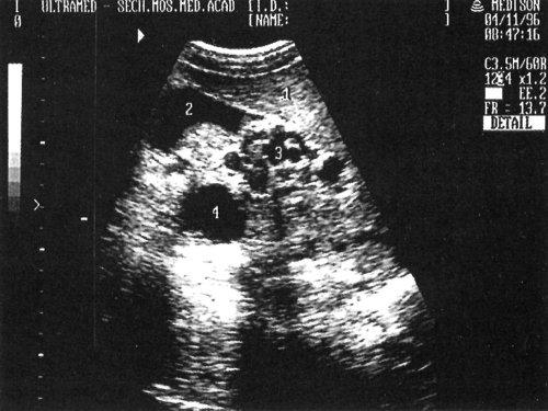 Точное расположение почек и печени в человеческом организме 04