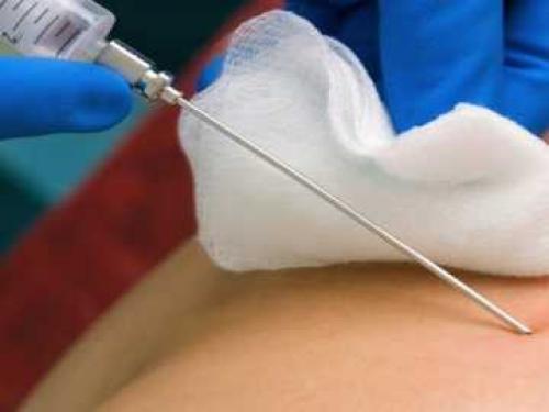 Что говорит ваша печень? Как распознать симптомы заболевания 02