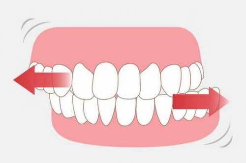 Секреты белоснежной улыбки: как сохранить здоровье зубов на долгие годы 05