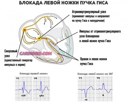Существуют ли препараты без побочных эффектов для сердца. Список антиаритмических препаратов для лечения разных видов аритмий, противопоказания и побочные действия