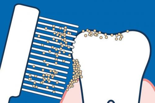 Топ-5 ошибок при уходе за зубами, о которых вы не подозревали 02 Топ-5 ошибок при уходе за зубами, о которых вы не подозревали 02