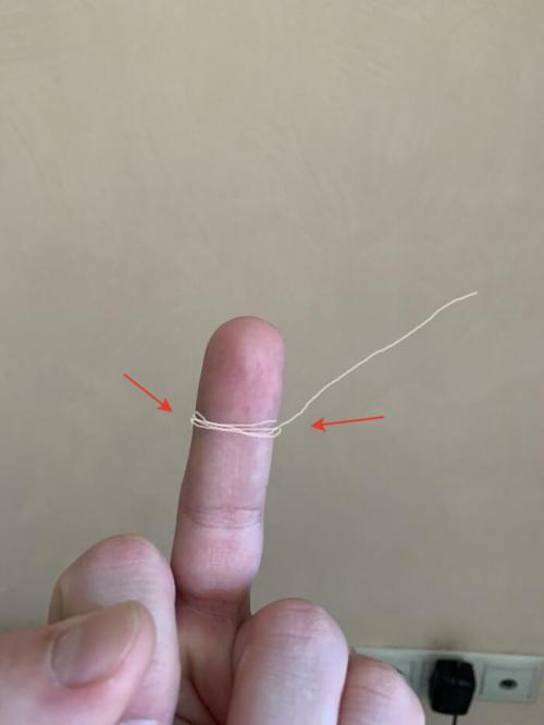 Почему использование зубной нити так важно, и какие ошибки при этом чаще всего допускаются. Сага о стоматологии. Глав. Как пользоваться зубной нитью и стоит ли вообще?