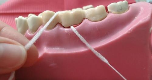 Почему использование зубной нити так важно, и какие ошибки при этом чаще всего допускаются. Сага о стоматологии. Глав. Как пользоваться зубной нитью и стоит ли вообще?