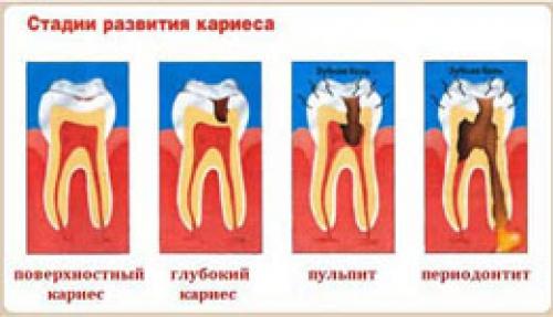 Полное руководство: 9 правил ухода за полостью рта 06 Полное руководство: 9 правил ухода за полостью рта 06