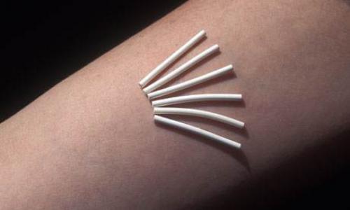 Какие методы защиты от нежелательной беременности являются наиболее эффективными и безопасными. Гормональные инъекции