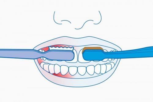 Самые частые ошибки в гигиене зубов: что нужно знать каждому 03