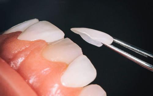 Основные ошибки гигиены зубов: как избежать их для здоровой улыбки 03