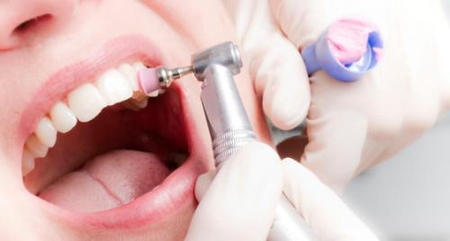 Почему чистка зубов важна для общего здоровья. Новая услуга: